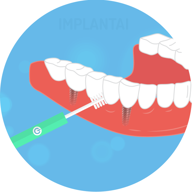 Dental Implantai Implantaiplius
